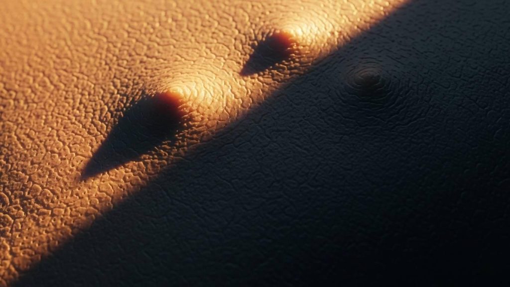 pigmentatsija kozhi prichiny i effektivnye metody bor by 2